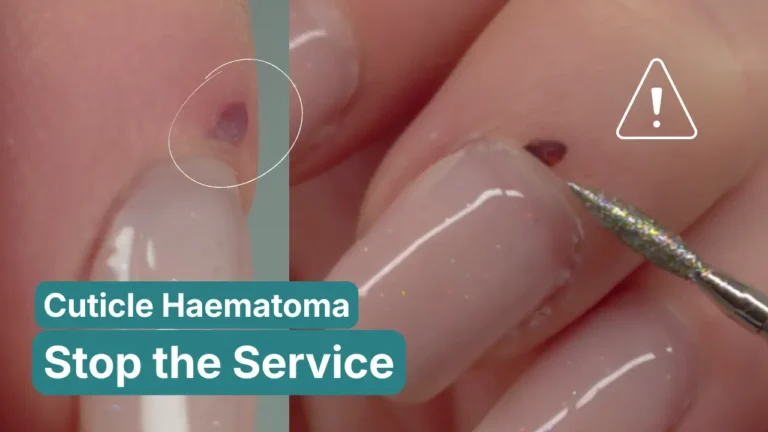 Close-up of cuticle haematoma with e-file bit approaching nail, showing when to stop any nail service - professional nail safety education by Radina Ignatova