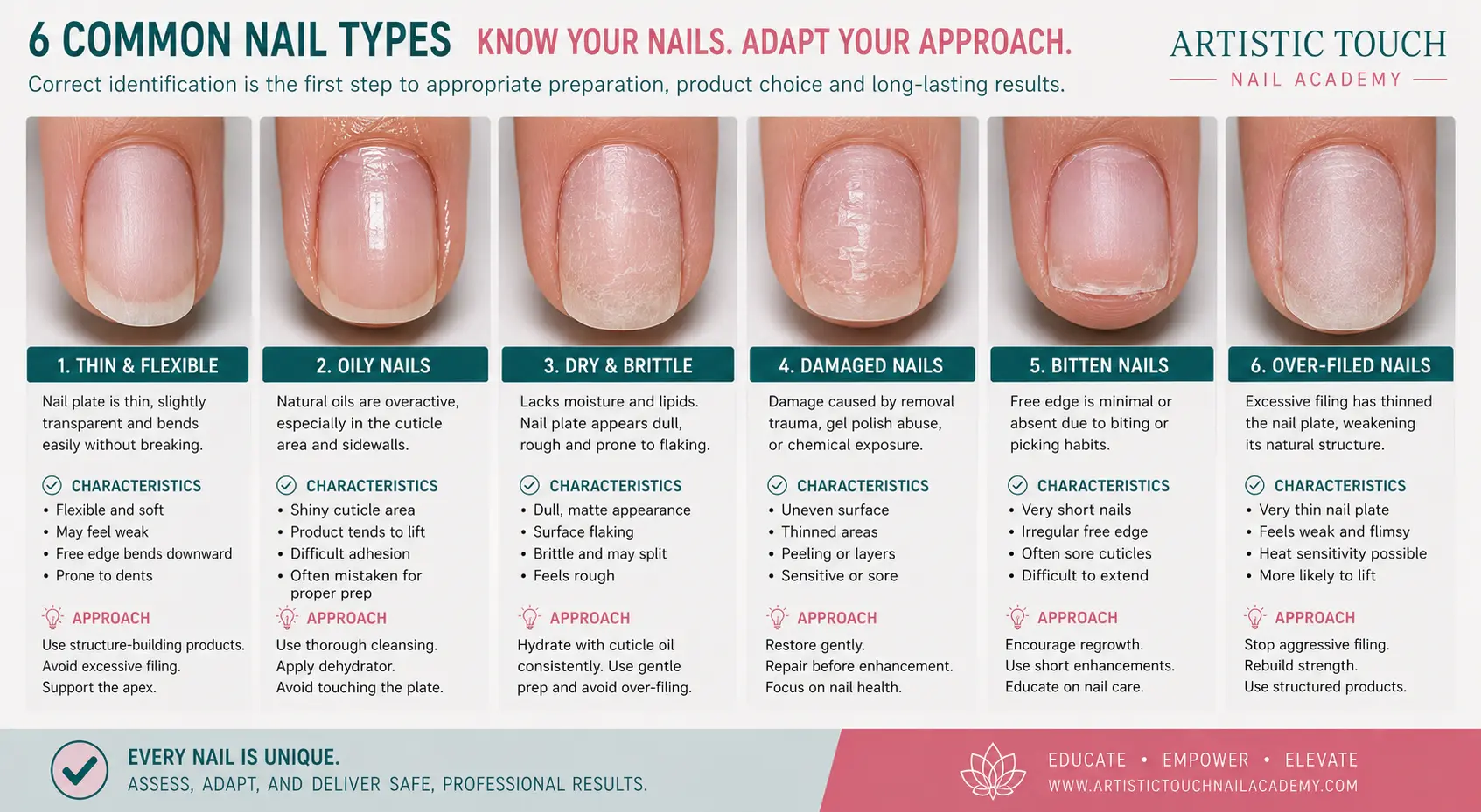 Educational comparison of six nail types showing thin flexible transparent nails, oily nails with visible shine, dry brittle flaking nails, damaged nails with irregularities, bitten nails with minimal edge, over-filed thinned nails requiring different preparation approaches